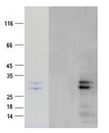 Lane 1. Purified recombinant HBsAg was analyzed by Tricine-SDS-PAGE 8- 20% gel, run with Tris-Glycine running buffer. 
Lane 2. Negative control protein 
Lane 3. HBsAg protein analyzed by Western blot using anti-His Mab